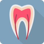 root canal therapy graphic